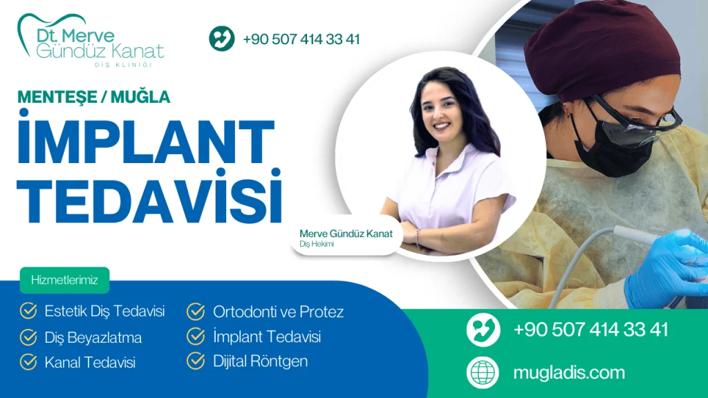Muğla Menteşe'de modern implant tedavisi hizmeti veren diş kliniği