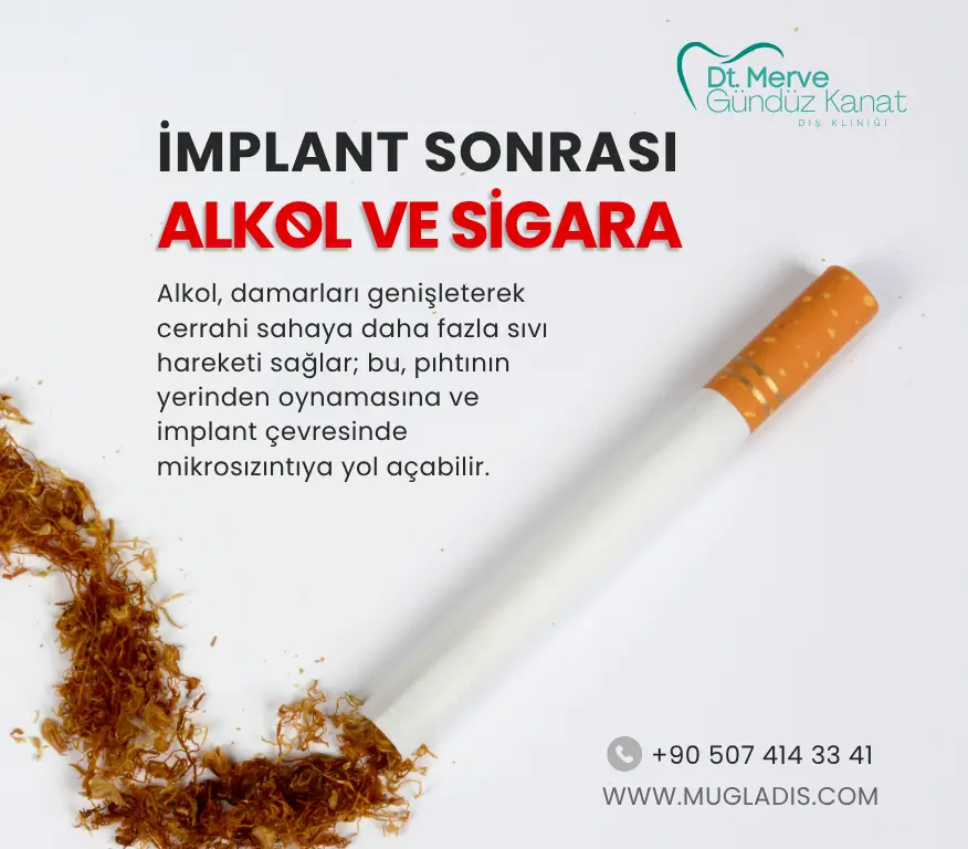 İmplant sonrası alkol ve sigara etkilerini gösteren infografik – Muğla