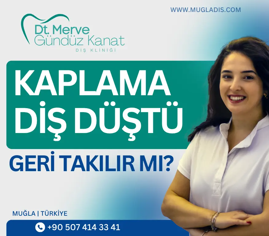 Düşen kaplama diş nasıl geri takılır – infografik