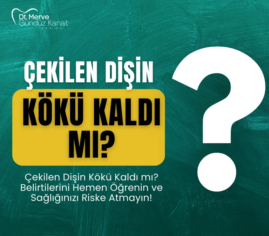 Çekilen dişin kökü kaldığında ortaya çıkan belirtileri anlatan bilgilendirici banner görseli. Diş kökü kalması ve tedavi süreci hakkında uyarıcı içerik.