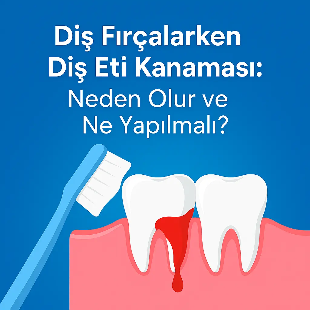 Diş fırçalarken diş eti kanaması neden olur ve nasıl geçer