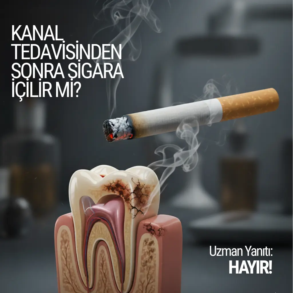 Kanal tedavisinden sonra sigara içilir mi