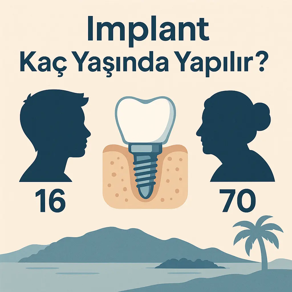 İmplant kaç yaşında yapılır sorusunu anlatan, yaş sınırı ve kemik gelişimini vurgulayan Muğla diş hekimi temalı görsel