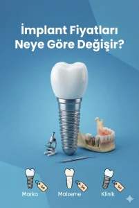 İmplant fiyatlarını etkileyen faktörler – muayene ve tedavi planlaması