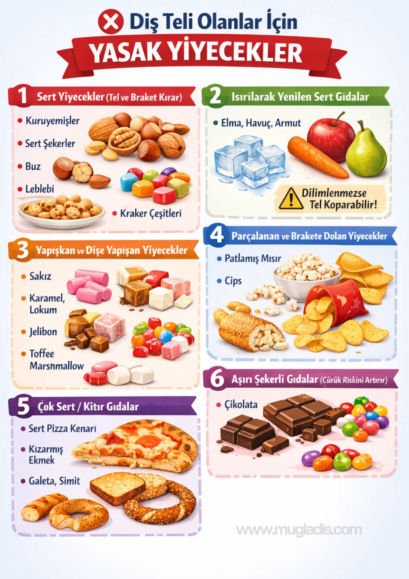 Diş teli olanlar için yasak yiyecekler listesi – tel ve braket kıran gıdalar